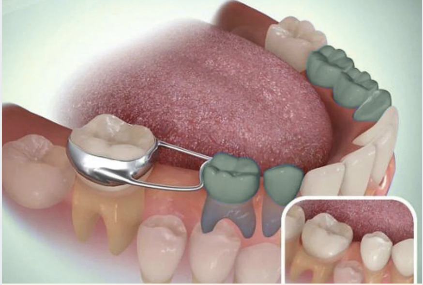 Προβλήματα Διατήρησης Χώρου