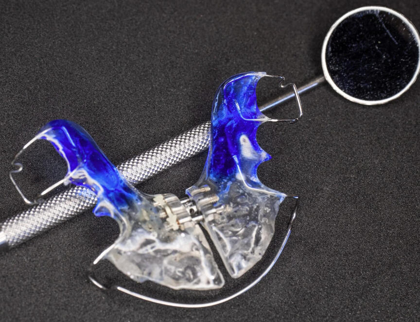 Σκελετικά Προβλήματα