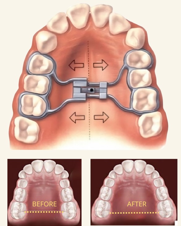 Σκελετικά Προβλήματα