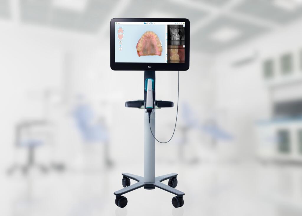 Ενδοστοματικός Σαρωτής (Scanner)